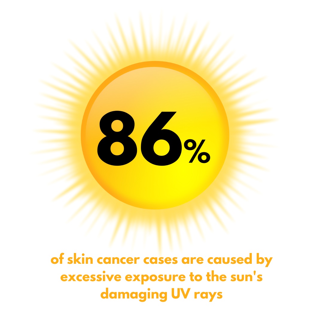 86 percent - skin cancer stat